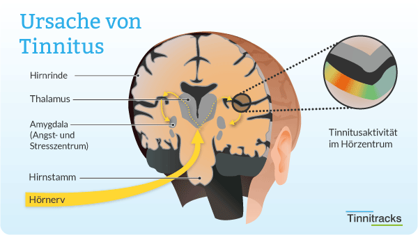 Ursache von Tinnitus